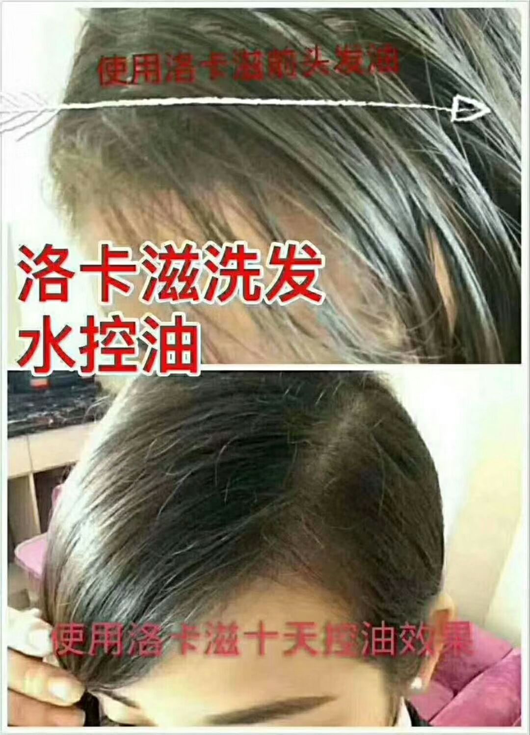 洛卡滋生姜洗发水