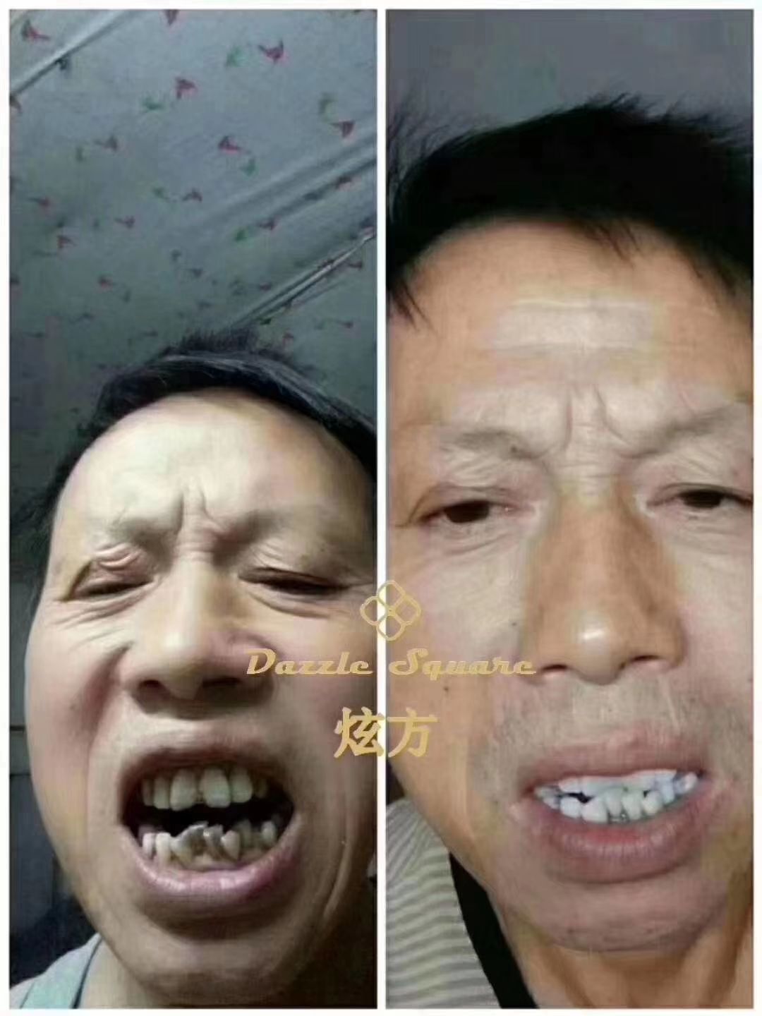 炫方冷光美牙