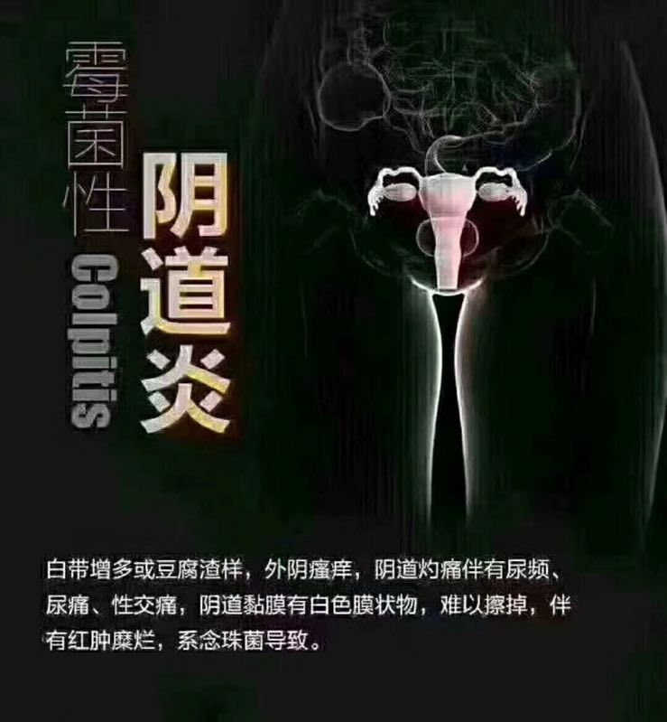佳茵女人的保护伞