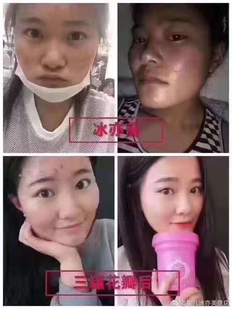 冰亦花瓣面膜 你值得拥有❤❤