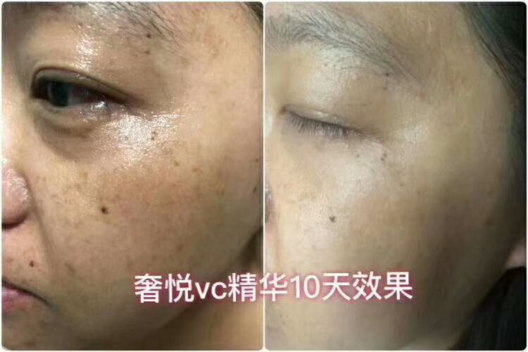奢悦vc精华