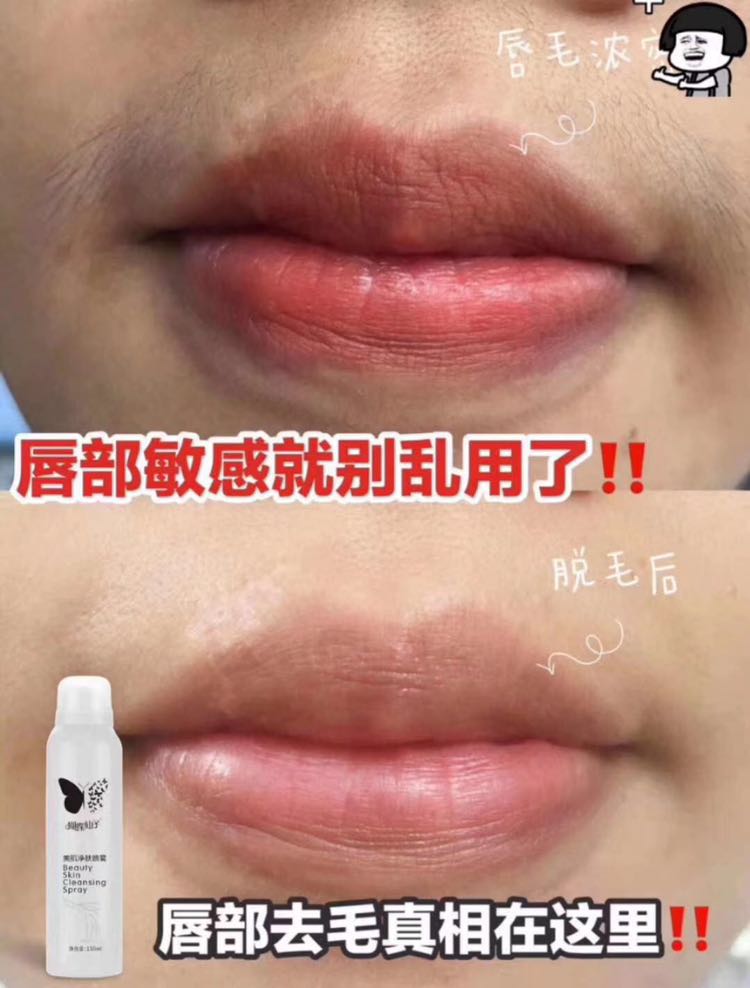 蝴蝶仙子脱毛喷雾