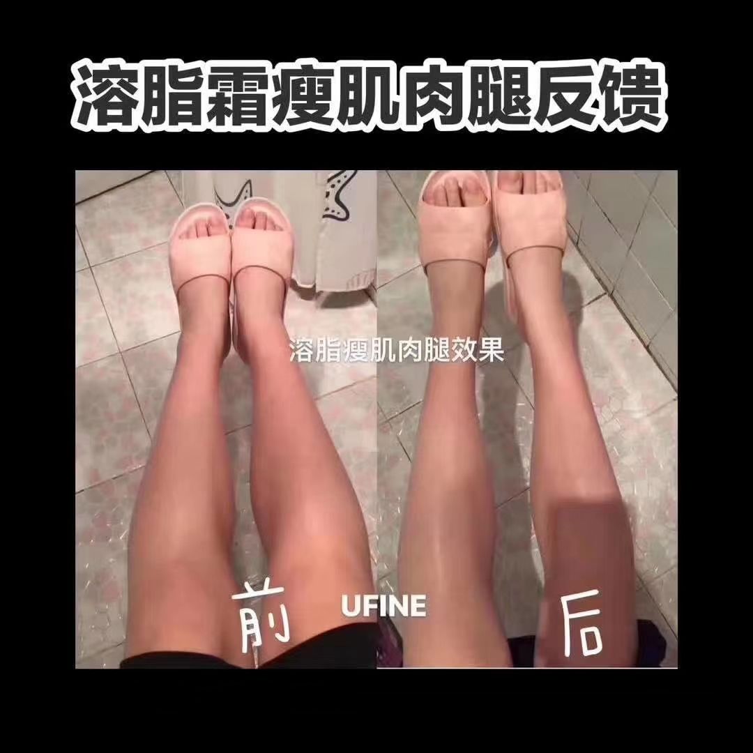 Ufine溶脂霜