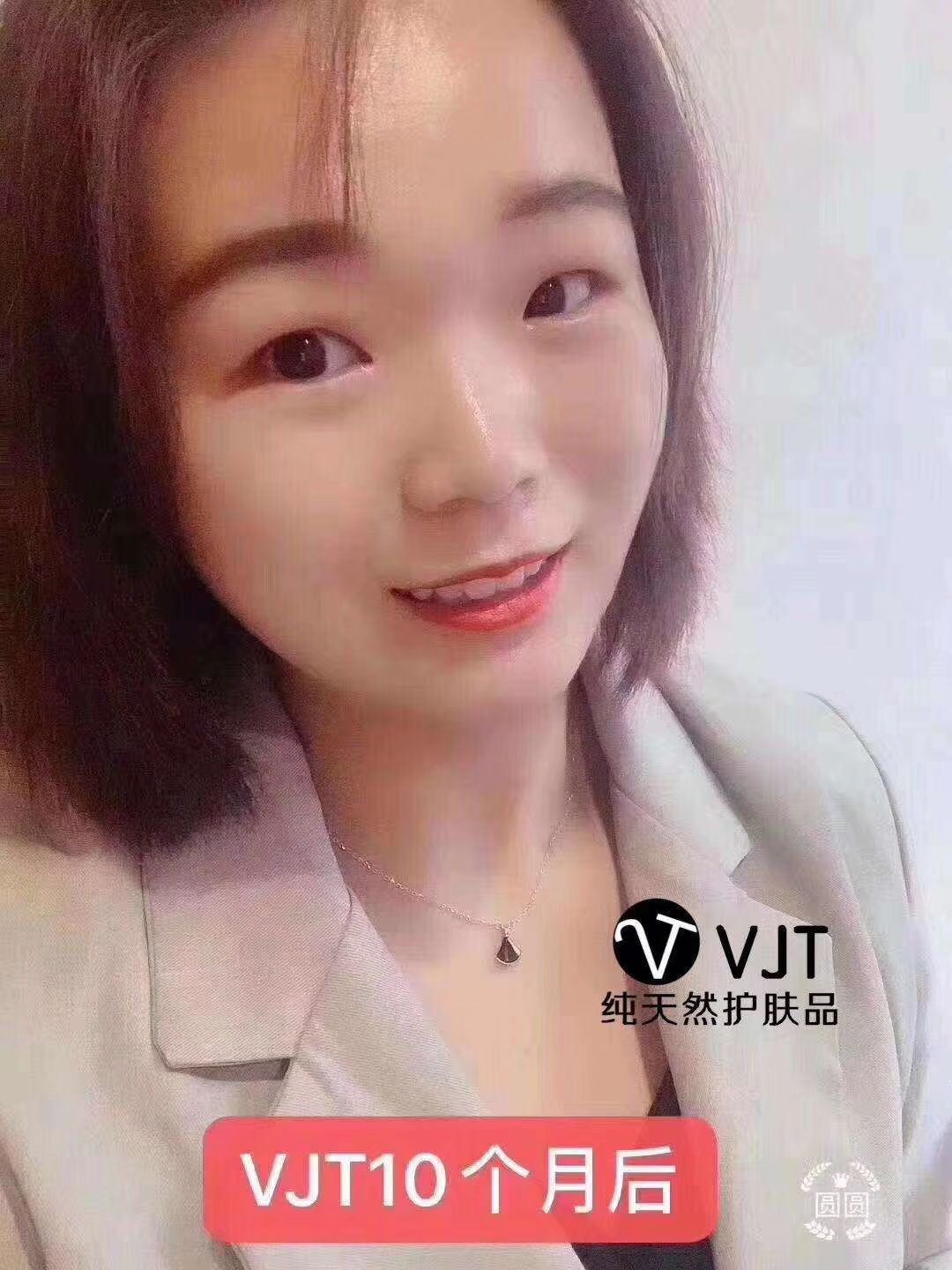 TGS活肤之泉