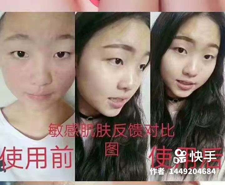 冰亦花瓣面膜