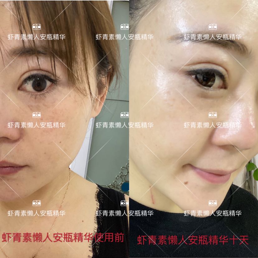 瑶玉阁虾青素懒人安瓶精华