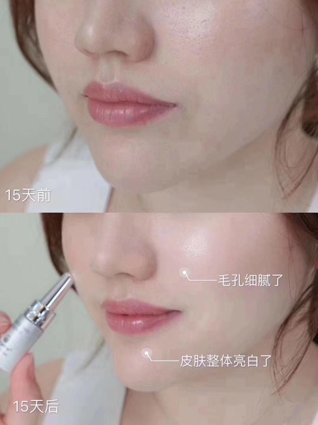 麦吉丽肌底液小银管好用吗？有效果吗？