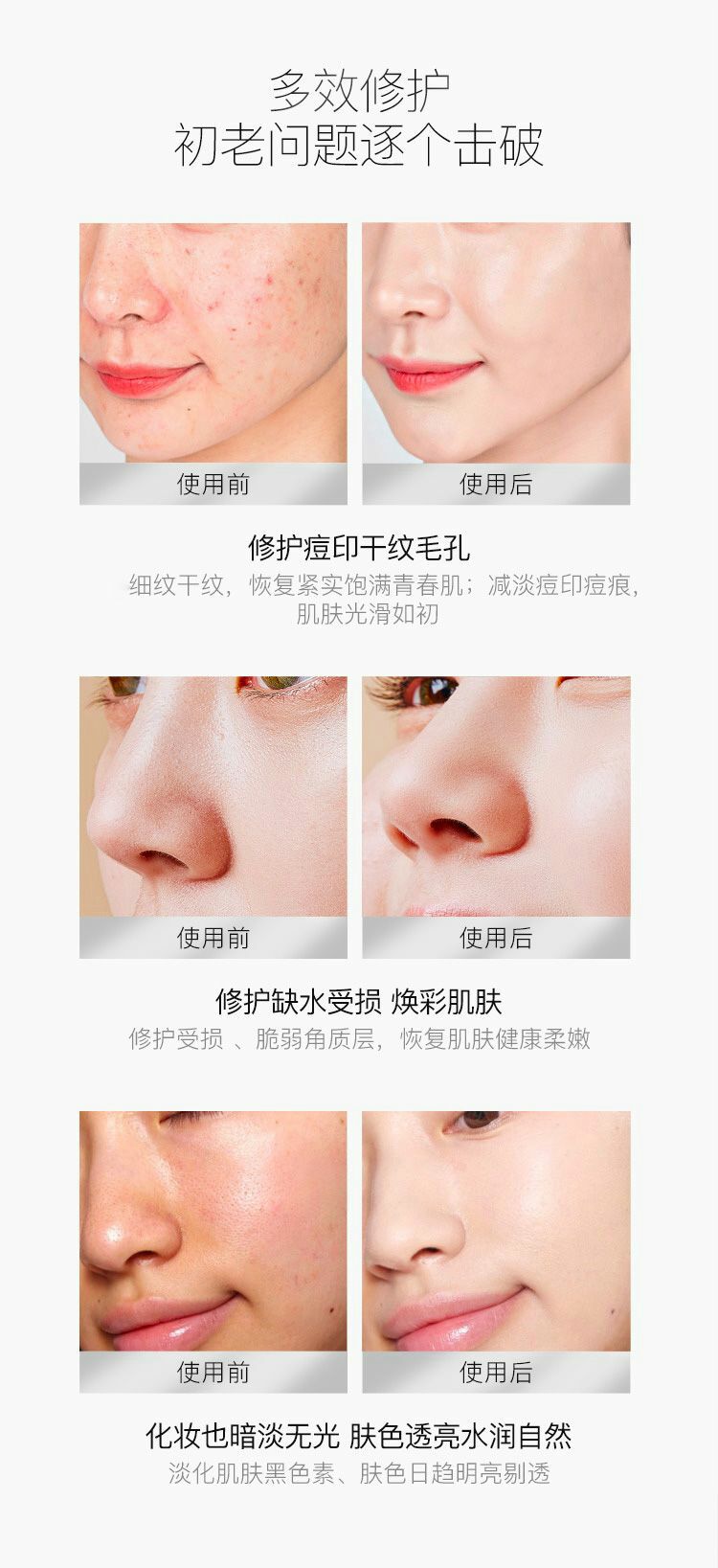 【买1赠1，实发2套】优理氏羊胎素淡纹弹嫩冻干粉套盒（2套）