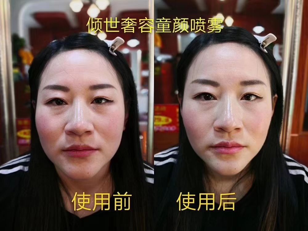 液态微整抗衰童颜喷雾