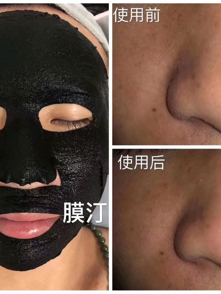 杜润膜汀面膜