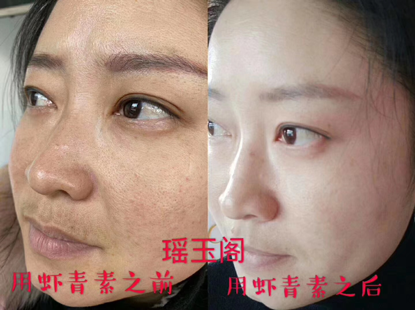 瑶玉阁虾青素懒人安瓶精华