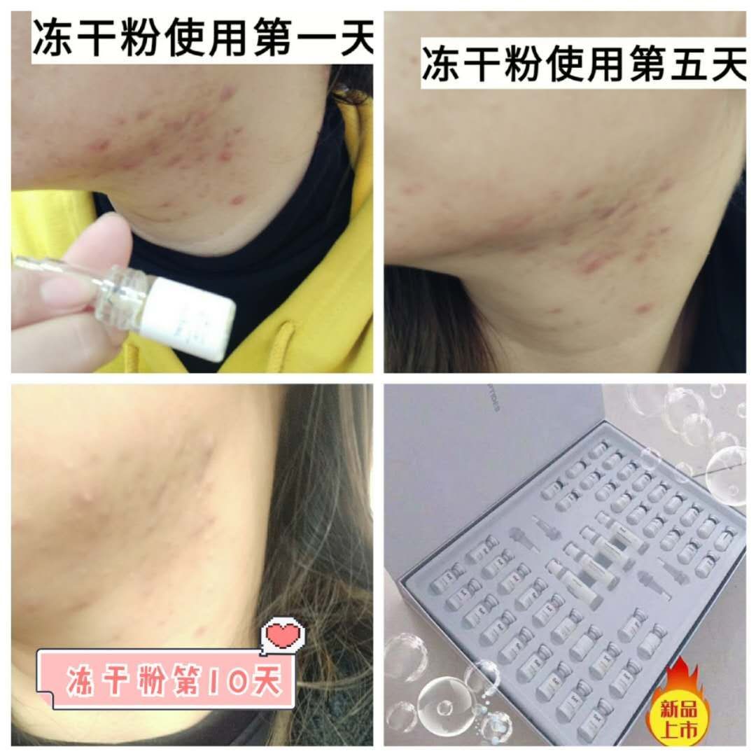 二裂酵母冻干粉