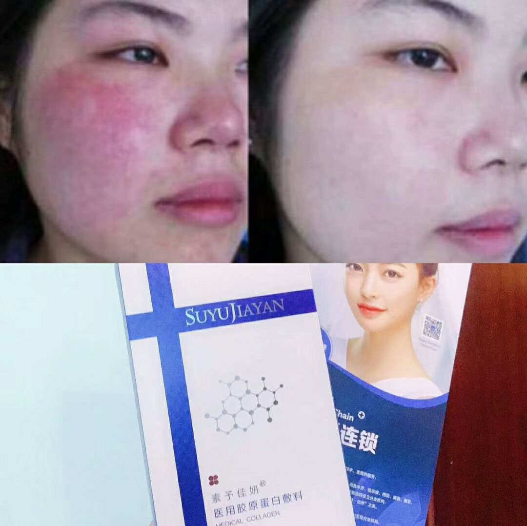 素予佳妍纯植物护肤产品