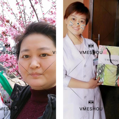 唯蜜瘦减肥瘦身，一款哺乳期妈妈都可以用的瘦身产品