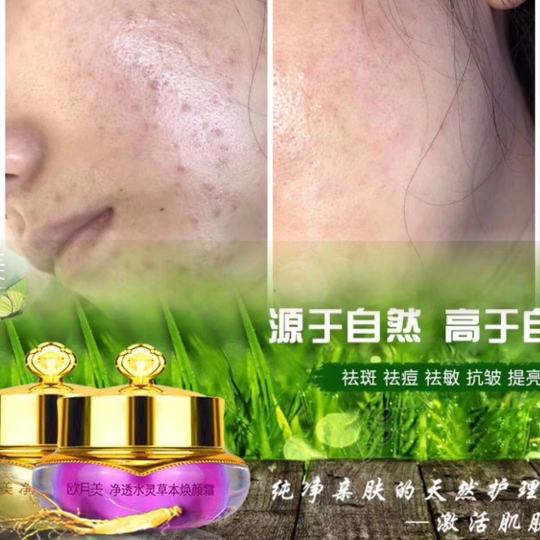 欧月美纯中药焕颜霜，祛斑祛痘，修复过敏