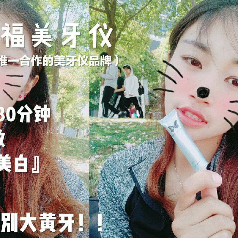 碧缇福美牙仪 7天见效15天无效退款